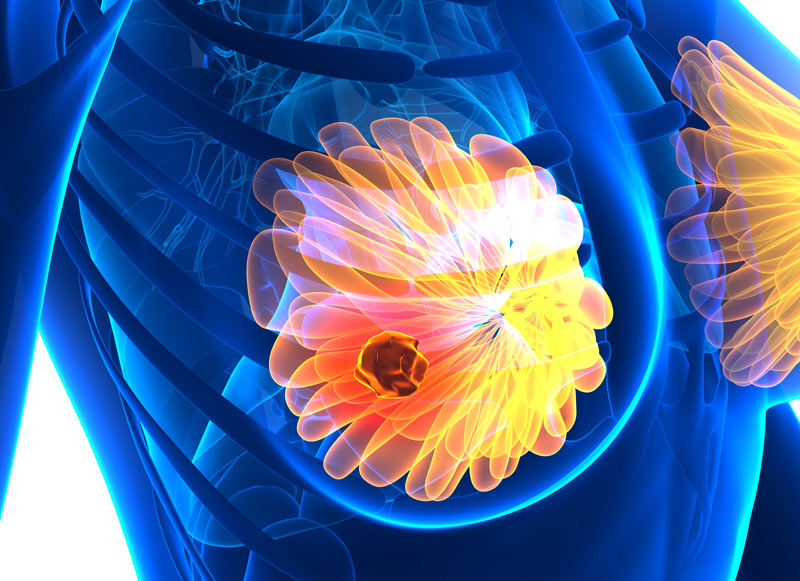 3D rendering of female body.